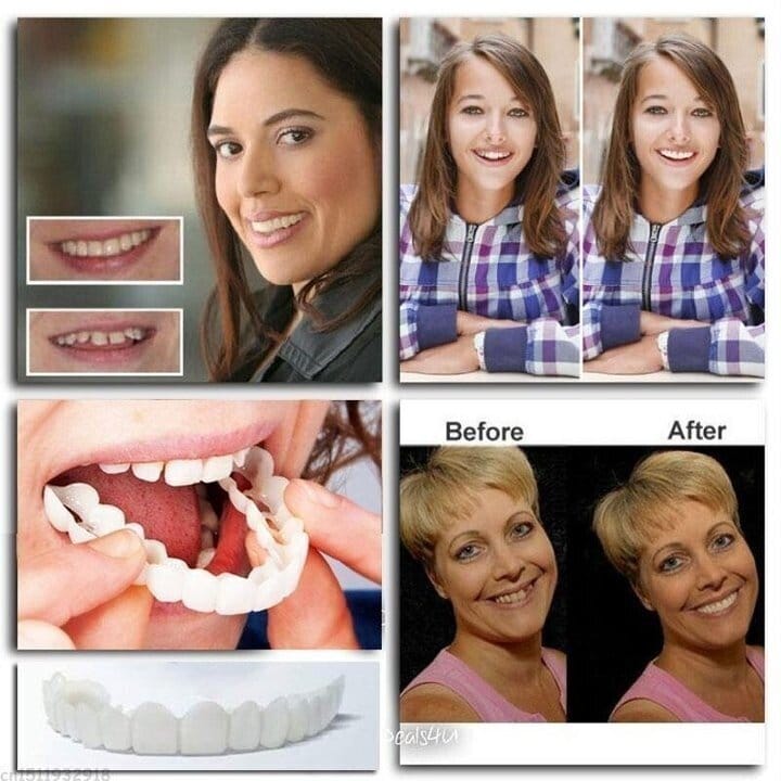 Last day discount-75%Off  Latest  Adjustable Snap-On Dentures